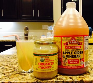 ACV